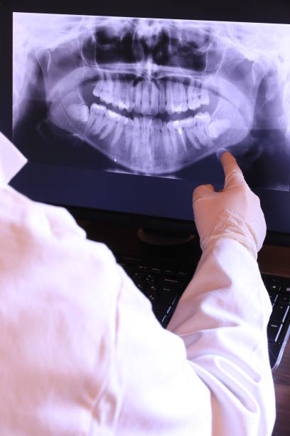 Best Emergency Treatment for Dental Infections or Abscesses in Troy, MO
