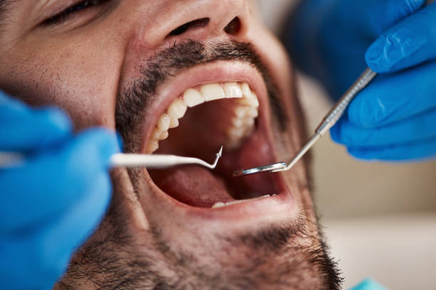 Best Emergency Denture Repair in Troy, MO